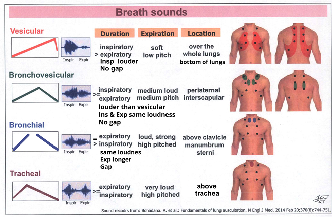 diseases with vesicular breath sounds